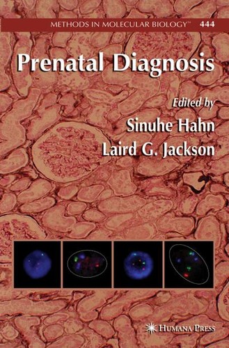 Prenatal diagnosis methods - prenatal,